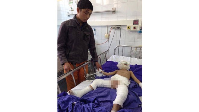 Ở nhà một mình, bé 4 tuổi bị bỏng xăng nguy kịch Bé Cường bị bỏng nặng nhất là vùng mặt, cổ, hai bên đùi và cơ quan sinh dục. Ảnh: VnExpress