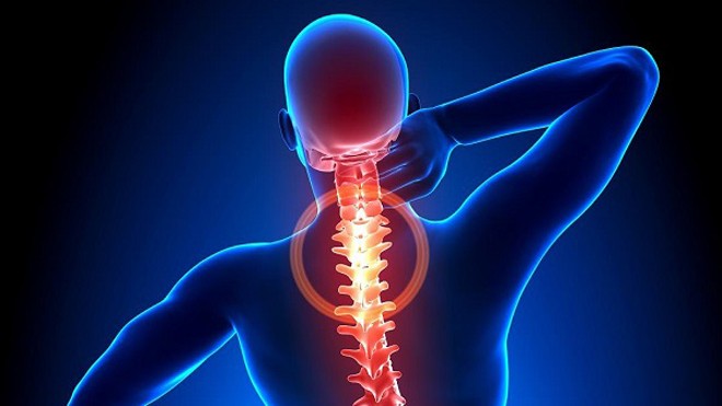 Chữa khỏi bệnh gai cột sống từ chanh, bưởi và ngải cứu Gai cột sống thường xuất hiện ở các đốt sống cổ hoặc đốt sống thắt lưng