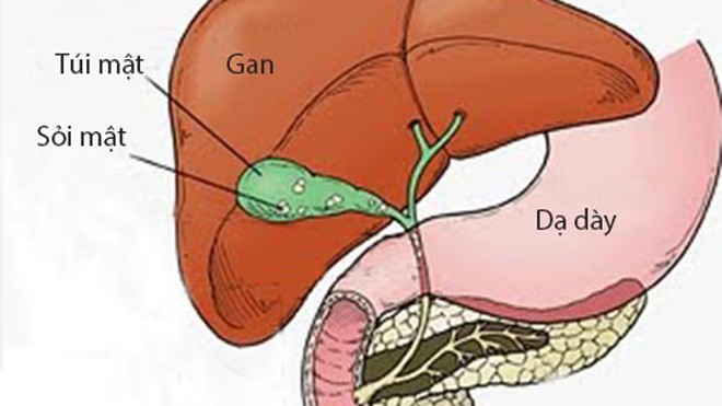 'Kẻ thù' của bệnh sỏi mật 'Kẻ thù' của bệnh sỏi mật