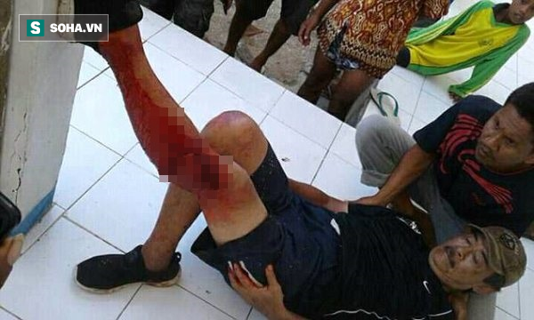 Rồng Komodo tấn công dã man du khách đang chụp ảnh 'tự sướng' Nạn nhân là ông Loh Lee Aik, 50 tuổi, một du khách người Singapore.