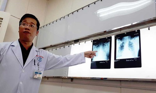Thực hư virus lạ gây ho sốt dẫn đến tử vong Phổi của bệnh nhân V. đã ổn định hơn sau hai ngày điều trị tại khoa ICU BV Chợ Rẫy.