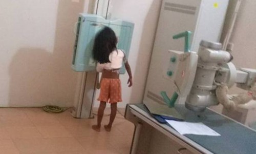 Học sinh lớp 1 bị cổng trường đè gãy xương vai: Phát ngôn sốc của hiệu trưởng? Cháu Phạm Thị Kim H. bị gãy xương đòn vai trái đang điều trị tại bệnh viện.