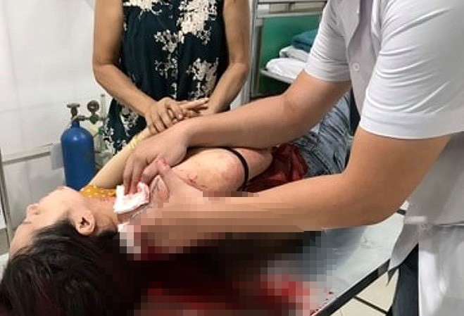 Rợn người cảnh người đàn ông thản nhiên đâm gục người phụ nữ Rợn người cảnh người đàn ông thản nhiên đâm gục người phụ nữ