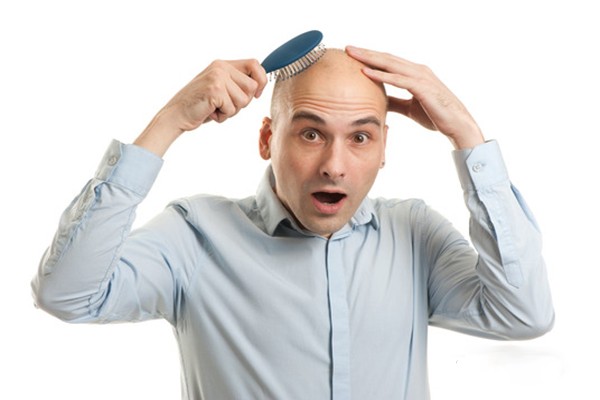 Đã tìm ra tế bào gây hói đầu và bạc tóc Hói đầu,bạc tóc, nỗi khổ tâm không của riêng ai