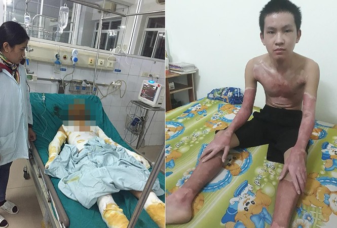 Sự sống hồi sinh nhờ thẻ Bảo hiểm Y tế Phan Anh Tuấn "hồi sinh" sau điều trị với sự đồng hành của tấm thẻ BHYT.