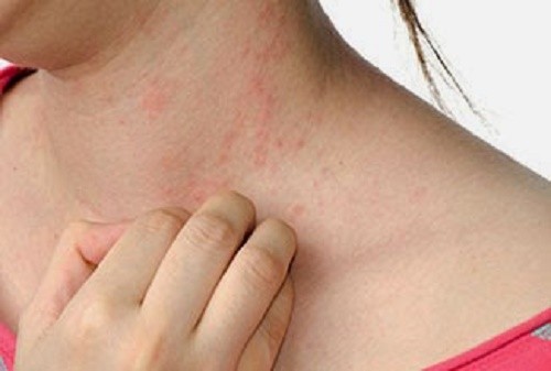 Mắc nhiều bệnh cực nguy hiểm từ ... quần áo Nhiều loại hóa chất độc hại làm tăng nguy cơ ung thư ở con người có trong các sản phẩm vải vóc. Ảnh minh hoạ: Internet