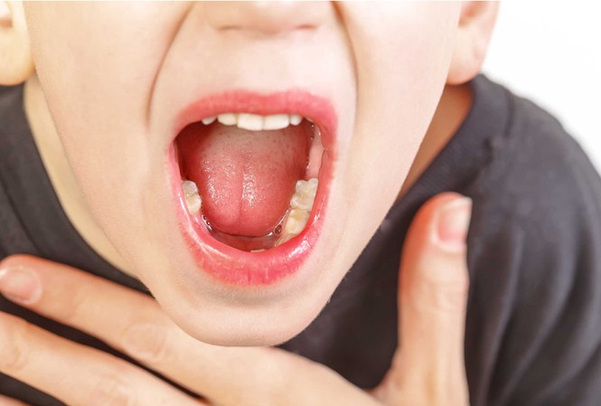 Bé 5 tuổi suýt chết vì phòng khám tư tiêm thuốc “ăn nhiều, hết ho” Ảnh minh hoạ:Internet