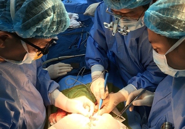 Sửa 'lỗi của tạo hoá' cho bé trai mặt như 'người ngoài hành tinh' Các BS Bệnh viện Nhi Trung ương trong một ca mổ