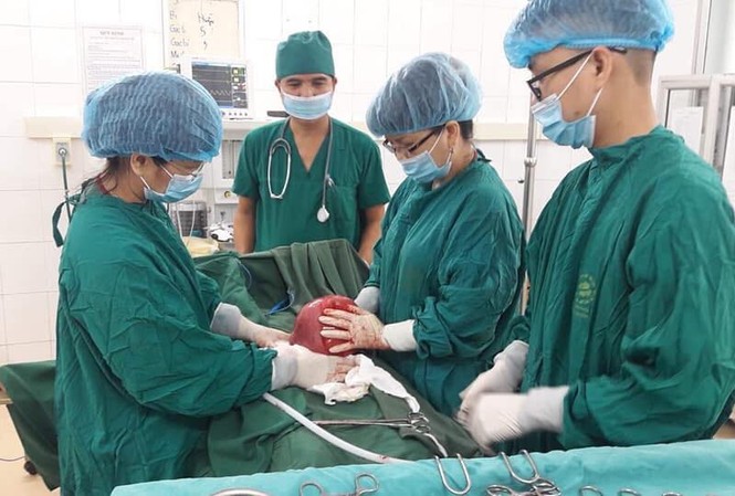 U xơ tử cung từ bé tý 'lớn' bằng quả bưởi vì ăn nhiều đậu nành Các bác sỹ thực hiện ca phẫu thuật u xơ tử cung cho bệnh nhân H.