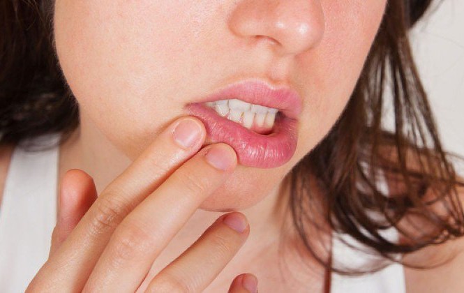 Nhiều trẻ dưới 15 tuổi biến chứng nặng vì bệnh lây qua đường tình dục Ảnh minh họa: Internet