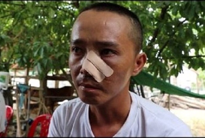 Nạn nhân kể lại 3 lần bị truy sát khiến cha chết, con trọng thương Nạn nhân kể lại 3 lần bị truy sát khiến cha chết, con trọng thương