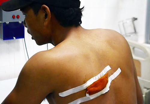 Hàng trăm cảnh sát truy bắt bốn nghi can bắn chết 3 người Một trong 15 người bị thương đang được điều trị tại bệnh viện. Ảnh: Thiện Nhân/VnExpress