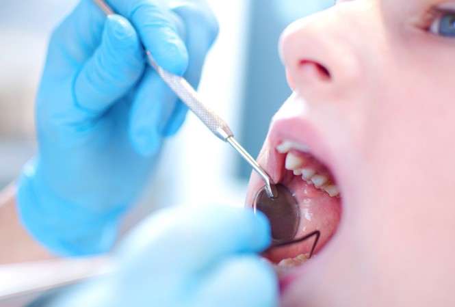 Khoa học thường thức: Nghiêm túc một cách hài hước về sâu răng Nên đi khám răng miệng thường xuyên, có răng sâu là phải chữa ngay. Ảnh: Raising Children Network.