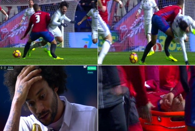 Vòng 22 La Liga xuất hiện 2 pha gãy chân kinh hoàng Tano Bonnin gãy chân kinh hoàng sau pha va chạm với Isco.
