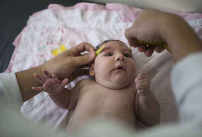 Trung Quốc xác nhận trường hợp đầu tiên nhiễm virus zika Virus zika gây dị tật đầu nhỏ bẩm sinh đang hoành hành ở châu Mỹ Latinh