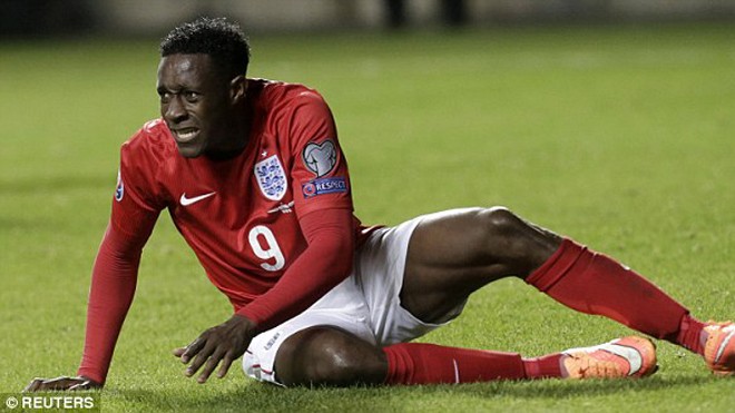Arsenal than trời vì 'bão' chấn thương Tới lượt Welbeck dính chấn thương