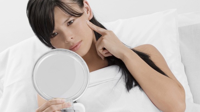 Tuổi dậy thì: “Bí kíp” sạch mụn trứng cá Ảnh minh họa