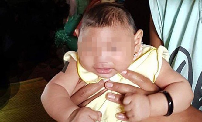 Ca mắc hội chứng đầu nhỏ do vi rút Zika đầu tiên ở Việt Nam Bé gái 4 tháng tuổi ở Đắk Lắk là ca mắc hội chứng đầu nhỏ do vi rút Zika đầu tiên tại Việt Nam. Ảnh: VTC.