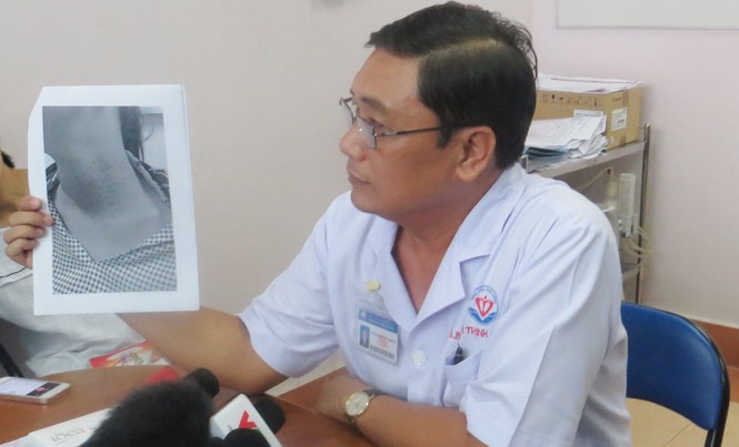 Một phụ nữ dị ứng nghiêm trọng do tự tiêm chất làm đẹp TS.BS Phạm Trịnh Quốc Khanh nói về trường hợp làm đẹp bị biến chứng của nữ bệnh nhân 40 tuổi.