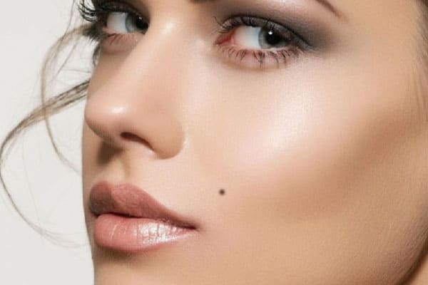 Cần khám ung thư ngay khi nốt ruồi có những dấu hiệu sau Những bất thường ở nốt ruồi có thể là ung thư da. Ảnh minh hoạ: Internet