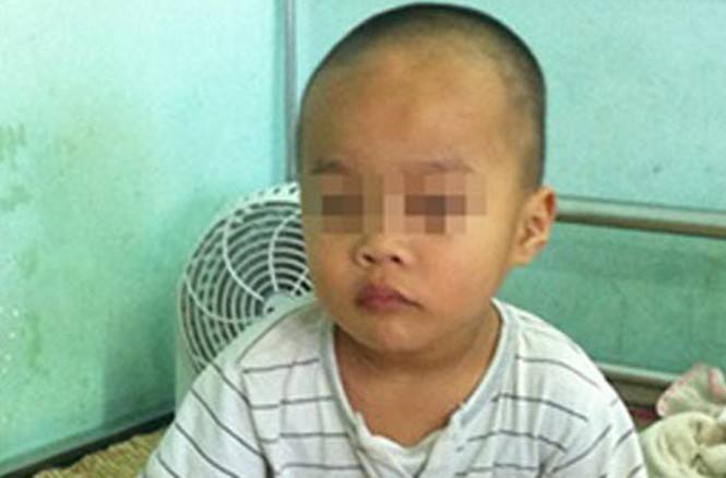 Cấp cứu kịp thời bé trai 3 tuổi bị xoắn tinh hoàn Bệnh nhân đã khỏe mạnh sau ca phẫu thuật xoắn ti nh hoàn do các bác sĩ Bệnh viện Nhi Trung ương thực hiện.