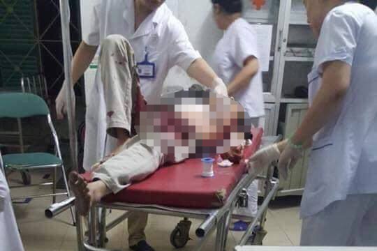 Mâu thuẫn, con rể dùng dao đâm bố mẹ vợ trọng thương Hai nạn nhân đang được cấp cứu trong tình trạng nguy kịch.