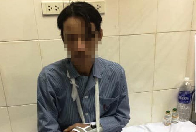 Nam công nhân môi trường bị đánh gãy tay vì bị nghi lấy trộm gạt mưa ô tô Anh P. đang được điều trị tại bệnh viện.