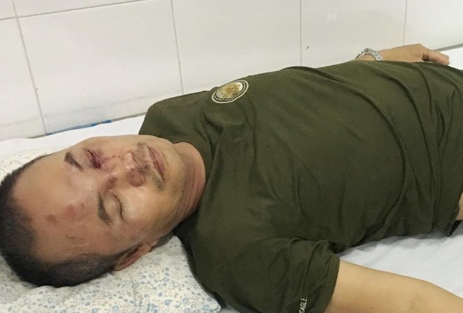 Bảo vệ chung cư gửi đơn nhận dạng, tố giác “côn đồ” Anh Hảo với nhiều vết thương chưa khỏi và vẫn phải nằm viện.