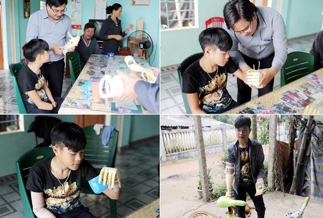 ĐH Duy Tân tặng cánh tay “Robot” cho học sinh khuyết tật ThS. Đặng Ngọc Sỹ (đứng) lắp Cánh tay “Robot”cho em Phan Trọng Hiếu để em có thể uống nước, đi xe đạp.