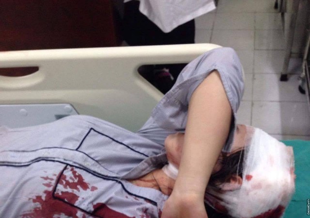 Hà Nội: Sở GD&ĐT lên tiếng vụ nữ sinh bị đánh gãy tay ở cổng trường Nữ sinh K.C cấp cứu tại bệnh viện sau khi bị đánh (ảnh mạng xã hội)