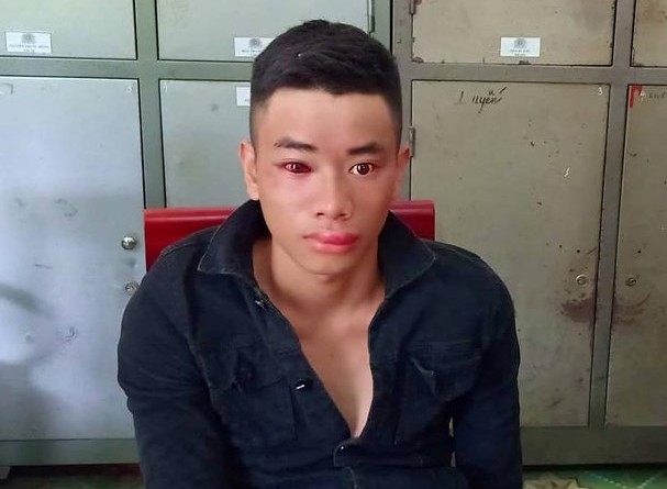 Thiêu úy công an phải chống phơi nhiễm HIV sau khi khống chế 'con nghiện' Thiêu úy công an phải chống phơi nhiễm HIV sau khi khống chế 'con nghiện'