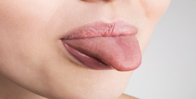 7 loại bệnh về lưỡi thường gặp 7 loại bệnh về lưỡi thường gặp