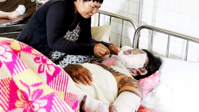 Thông tin mới về vụ 2 người mẹ bị tạt xăng thiêu sống Chị A Sì Giá điều trị tại bệnh viện trong tình trạng bị bỏng nặng