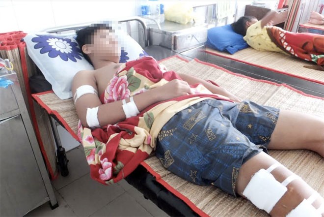 Đang đứng trước nhà, một học sinh lớp 10 bị chém nhập viện Em T. đang được điều trị tại bệnh viện