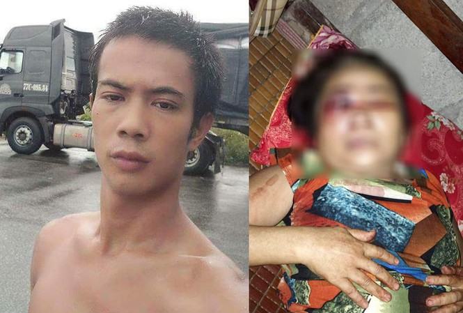 Mâu thuẫn trên chiếu bạc, người phụ nữ bị đánh hỏng mắt Mâu thuẫn trên chiếu bạc, người phụ nữ bị đánh hỏng mắt