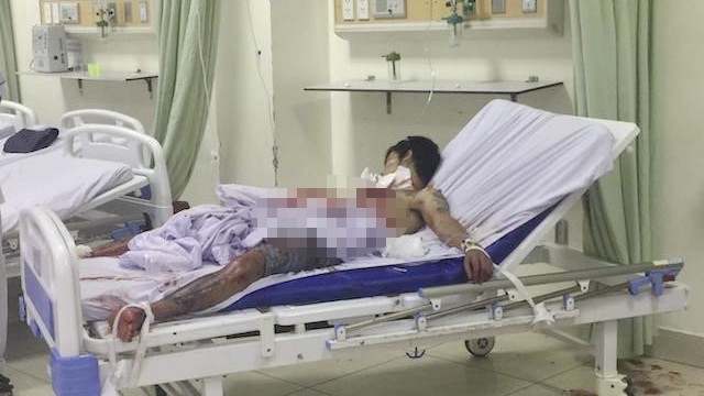 Bác sĩ cứu sống nam thanh niên ‘ngáo đá’ tự cứa cổ Nam bệnh nhân đang điều trị tain bệnh viện