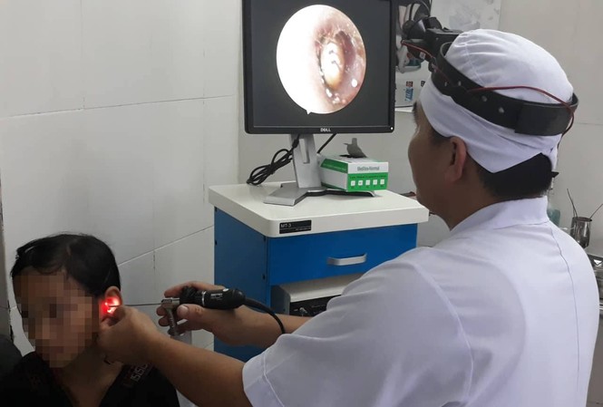 Bọ ve chó sống trong tai bé gái 10 tuổi Bọ ve chó sống trong tai bé gái 10 tuổi