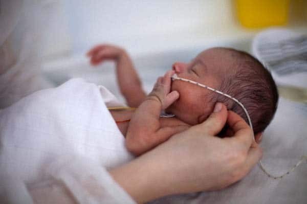 Bé trai 5 tháng tuổi phổi trắng xóa vì nhiễm lao từ cha ảnh minh họa