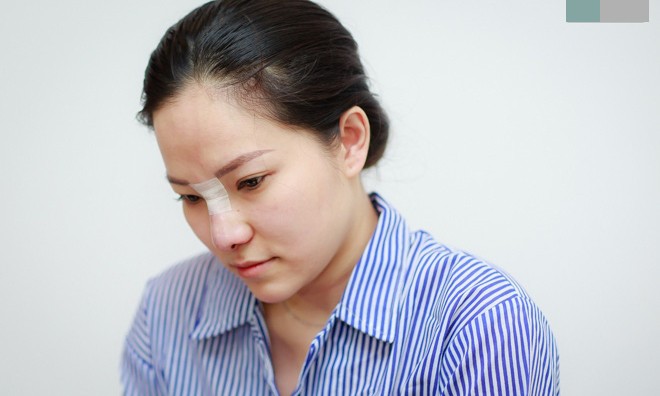 Vợ cũ Lâm Vinh Hải sửa mũi, tuyên bố: 'đã đến lúc tôi sống cho mình' Lý Phương Châu quyết định sửa mũi để đón nhận những điều mới trong cuộc sống.