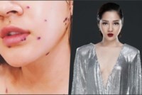 Bảo Anh - 'Tình tin đồn' của Bùi Tiến Dũng nhập viện vì kiệt sức Bảo Anh - 'Tình tin đồn' của Bùi Tiến Dũng nhập viện vì kiệt sức
