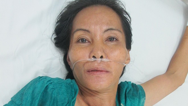 Đâm xuyên sọ bé sơ sinh vì bị thông gia chê tâm thần Bà Vân nằm trong bệnh viện. Ảnh: Hòa Hội