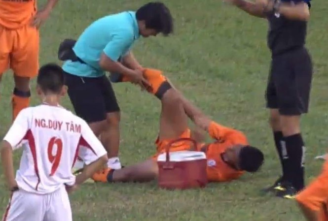 Đội trưởng U19 SHB Đà Nẵng gãy gập chân trong trận đấu với HAGL Duy Bảo gãy chân vì vào bóng thô bạo với đối thủ