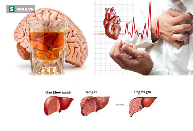Uống rượu bia thường xuyên: 5 cơ quan nội tạng “bốc hơi” đáng giật mình Uống rượu bia thường xuyên: 5 cơ quan nội tạng “bốc hơi” đáng giật mình