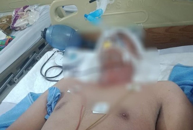 Mâu thuẫn trong lúc xem đá gà, cựu thủ môn bị đánh dẫn đến tử vong Anh Tấn tử vong do chấn thương sọ não.