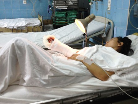 Cô gái đi xe SH bị cướp chém gần lìa tay Cô gái đi xe SH bị cướp chém gần lìa tay