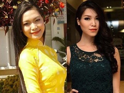 Tiết lộ giá nâng mũi, gọt cằm của giới nghệ sĩ Tiết lộ giá nâng mũi, gọt cằm của giới nghệ sĩ