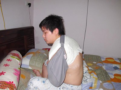 Gãy xương vì xô xát với công an? Nguyễn Hoài Linh phải bó bột sau khi va chạm với lực lượng làm nhiệm vụ