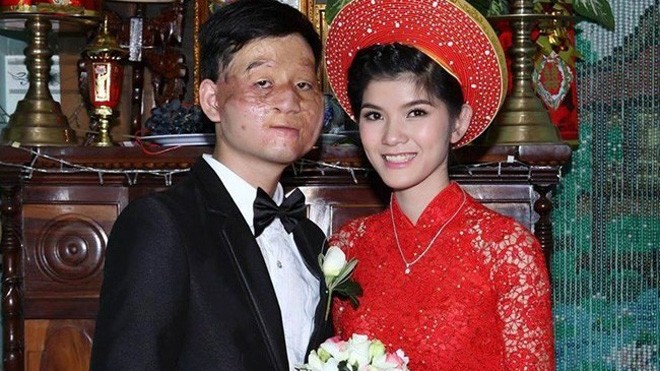 Tình yêu cổ tích không tưởng chấn động mạng Việt Tấm ảnh đang gây bão dư luận về tình yêu không biên giới của cặp đôi trẻ.