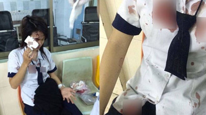 Thả phân vào thùng rác, nữ sinh bị đánh đập thậm tệ Thả phân vào thùng rác, nữ sinh bị đánh đập thậm tệ