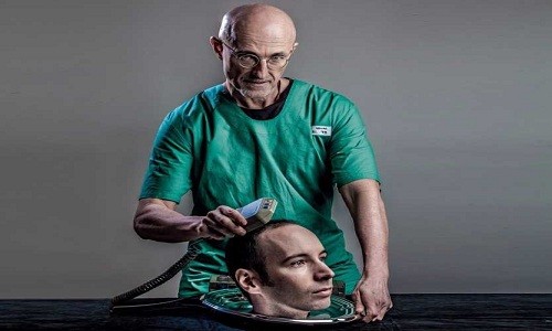 Bác sĩ Italy chứng minh phẫu thuật ghép đầu có thể thành công Bác sĩ Sergio Canavero dự định thực hiện phẫu thuật ghép đầu vào năm sau. Ảnh minh họa: The Why.